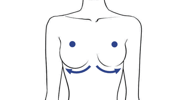 Схема лимфодренажного массажа груди