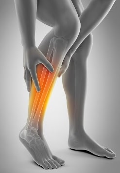Растяжение мышц на ноге икры, симптомы, лечение в Москве